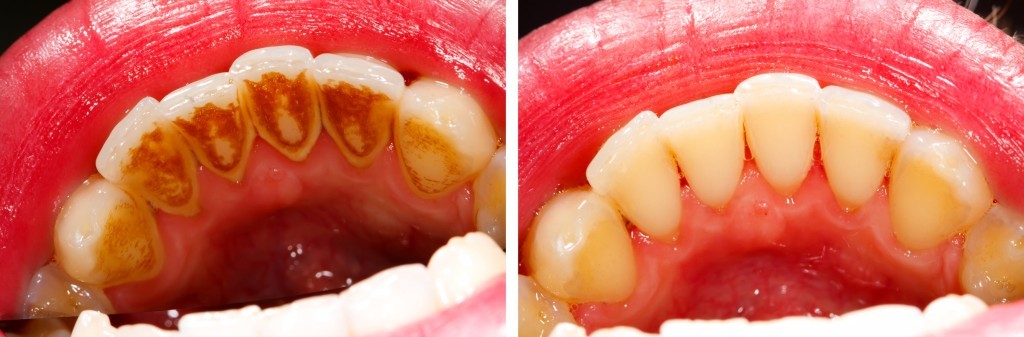 Egészséges fogak, őszinte mosoly – interjú Dr. Nagy Judit fogszakorvossal